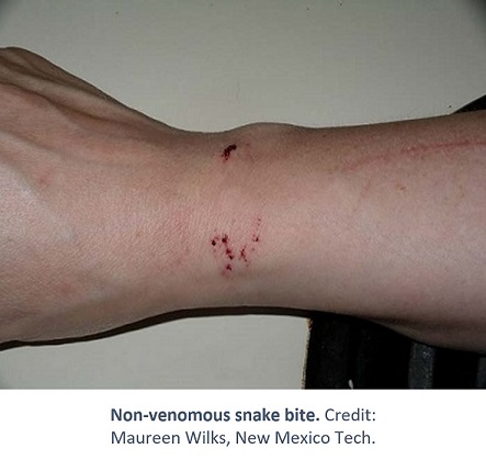 Types of Venomous Snakes, NIOSH